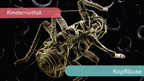 Kopflauswarnung in der KiTa – und jetzt?